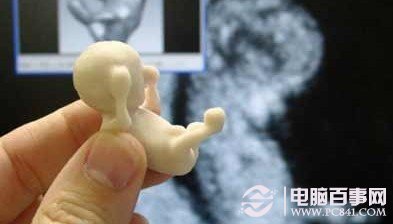 3D打印还可以打印人体器官